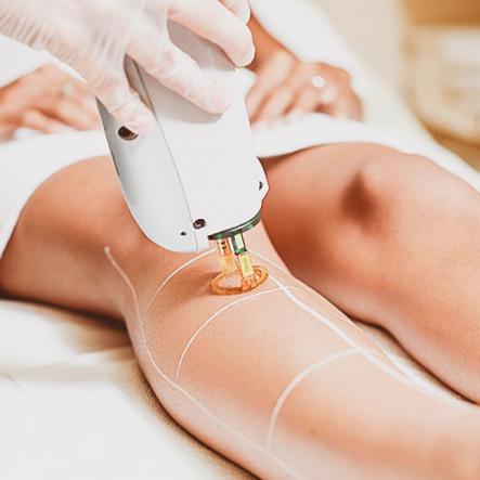 قیمت روز دستگاه لیزر موی زائد در تهران