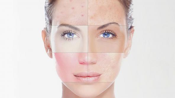 قیمت دستگاه پلاژن