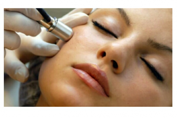 قیمت روز لیزر جوانسازی در تهران