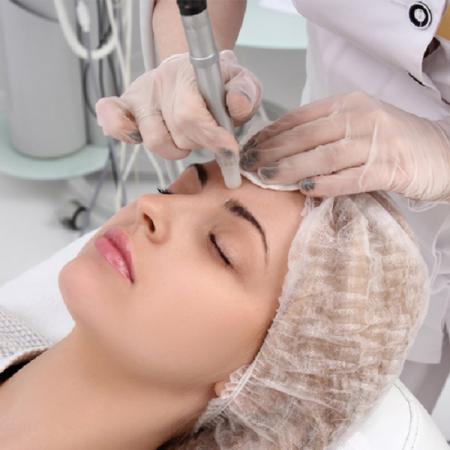 فروش لیزر جوانسازی اینترنتی